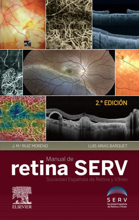  MANUAL DE RETINA SERV 