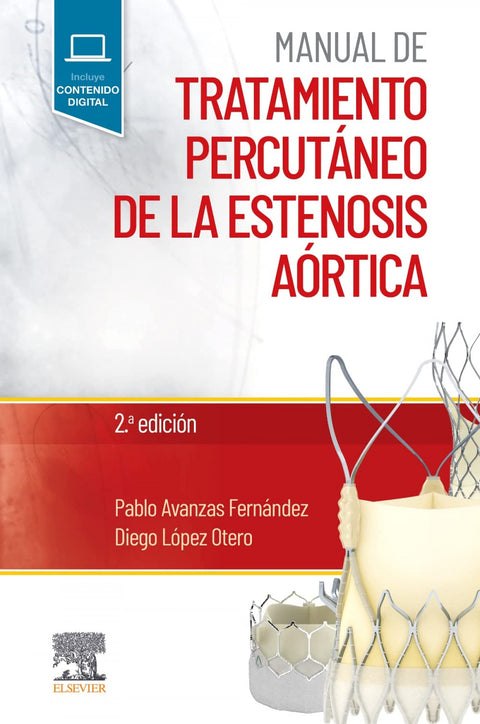  Manual de tratamiento percutáneo de la estenosis aórtica 