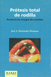  Avances en cirugía de revisión de la prótesis total de rodilla 