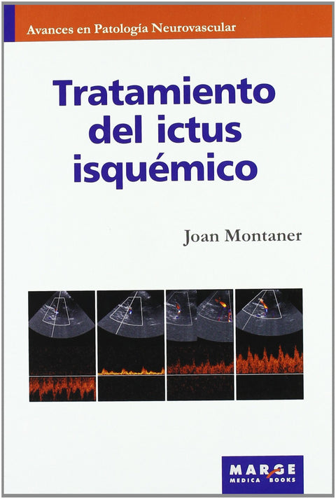  Tratamiento del ictus isquémico 