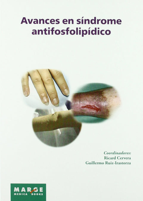  Avances en síndrome antifosfolipídico 