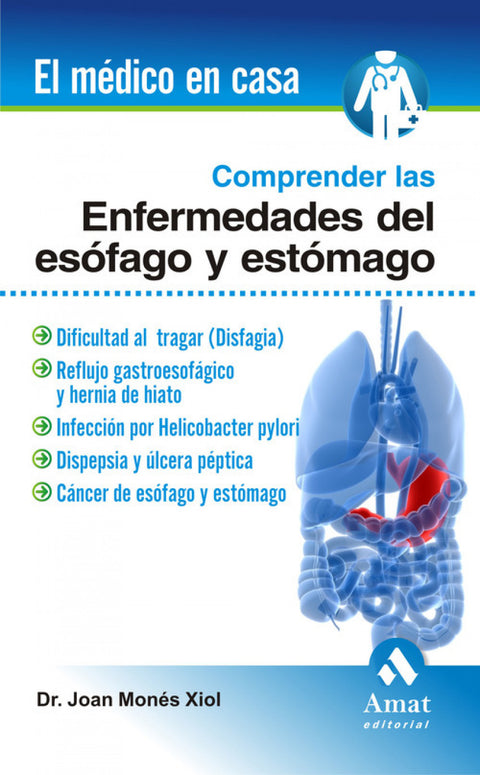  Comprender Las Enfermedades Del Esofago 