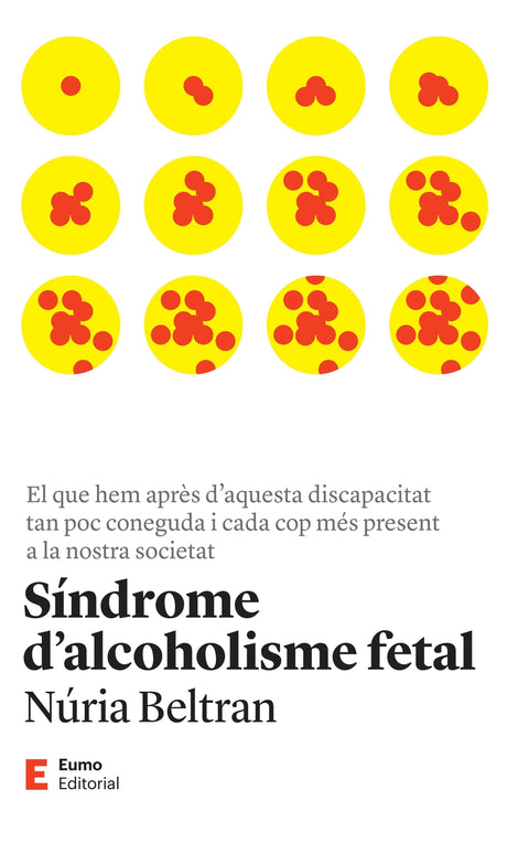  Síndrome d'alcoholisme fetal 