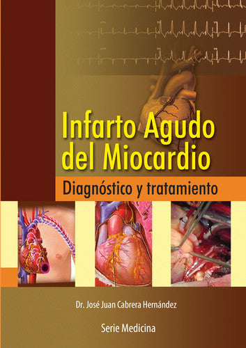  INFARTO AGUDO DEL MIOCARDIO 