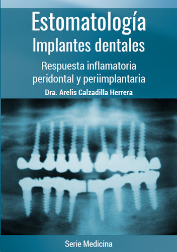  ESTOMATOLOGÍA. IMPLANTES DENTALES 