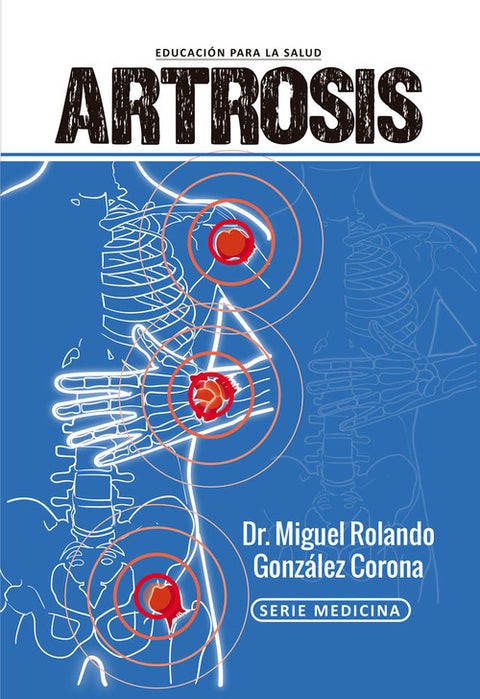  ARTROSIS 