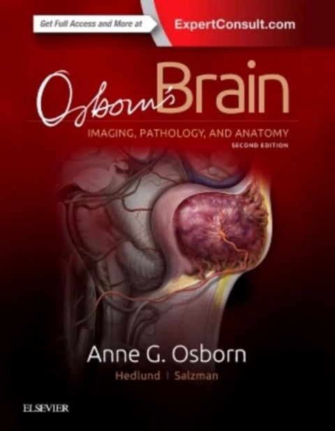  OSBORN'S BRAIN 
