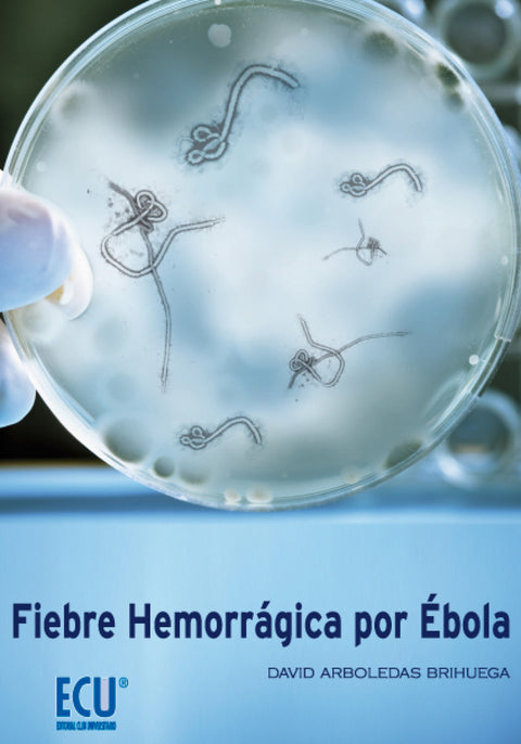  Fiebre hemorrágica por Ébola 